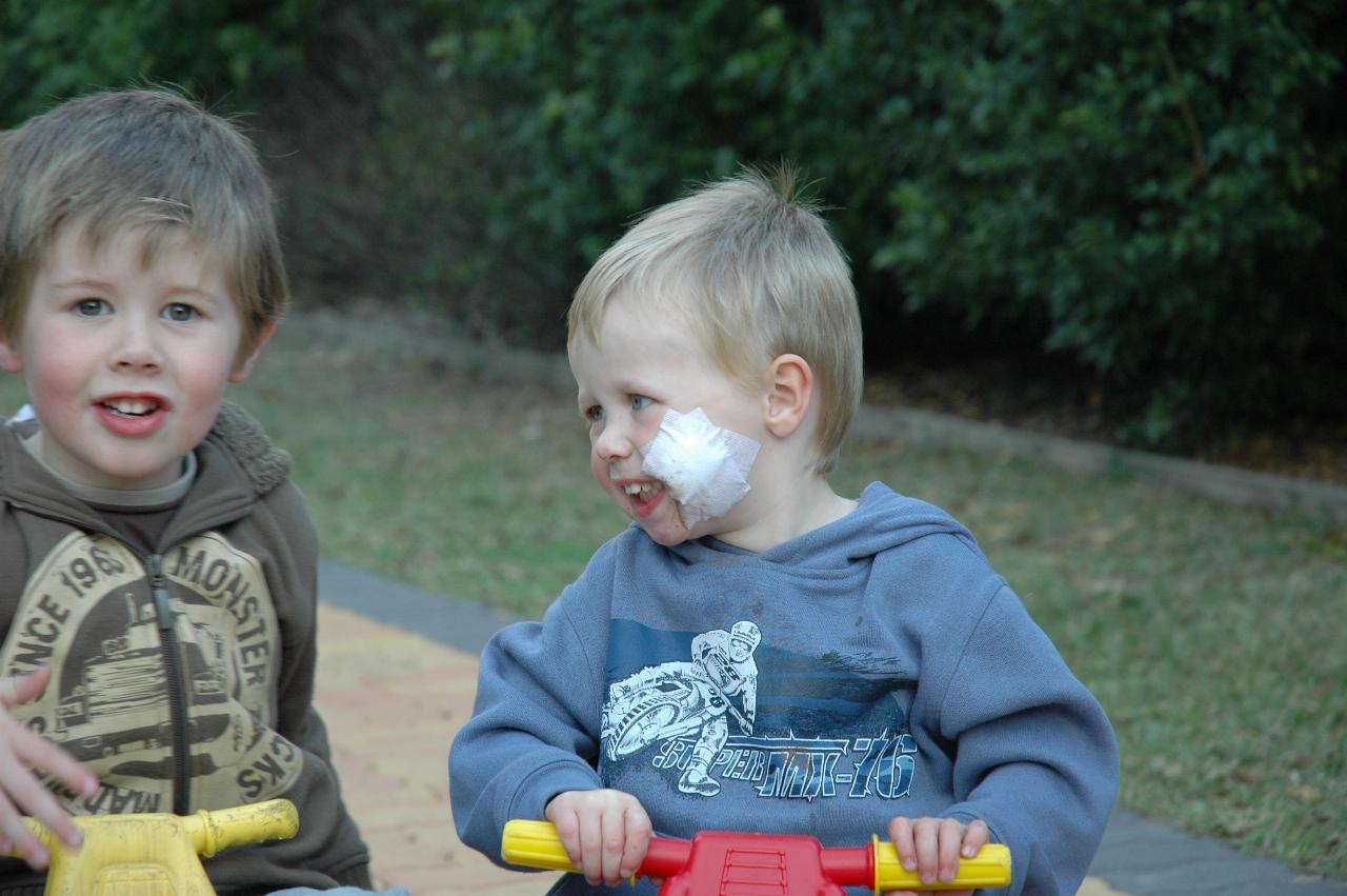 Jake and Flynn Crofts at home the day after Flynn's cyst was removed