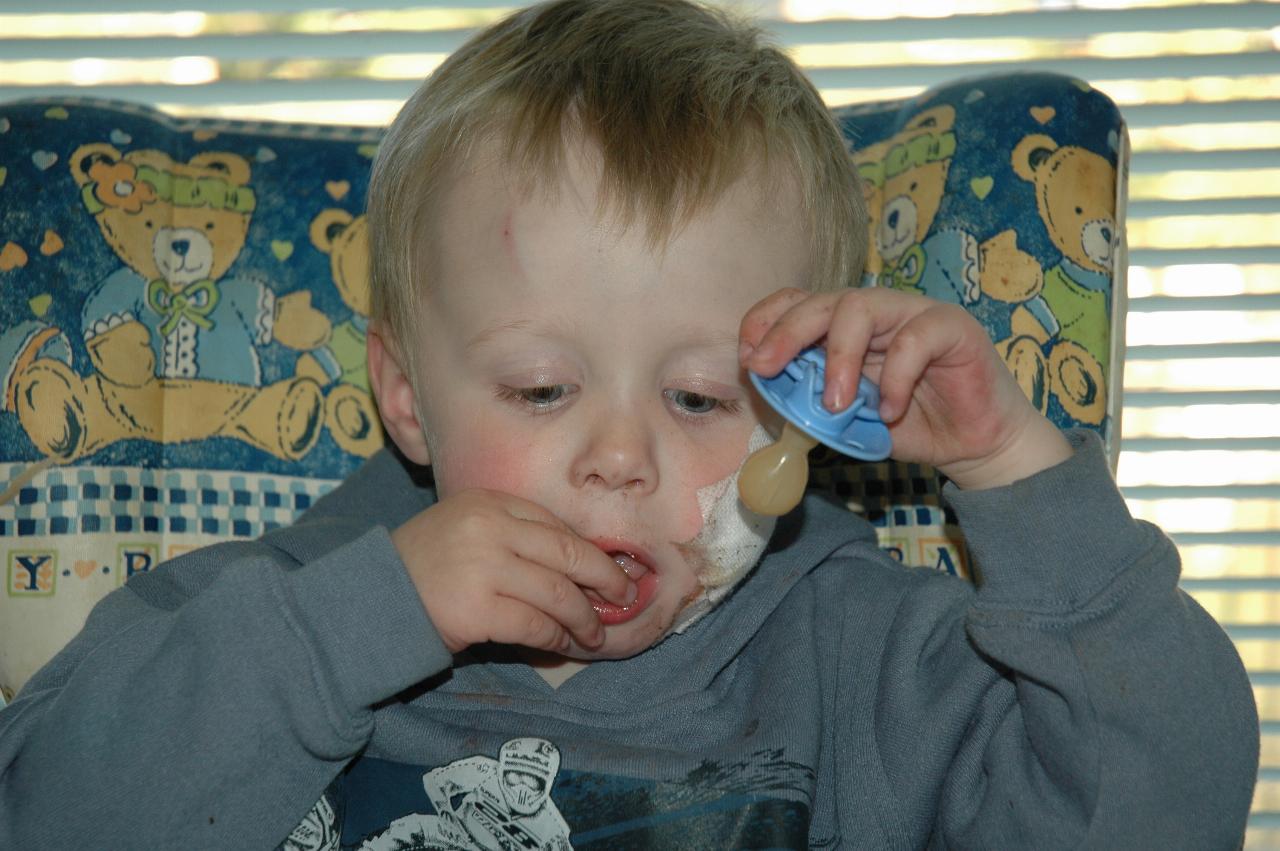 Flynn Crofts with cyst removal bandages eating \